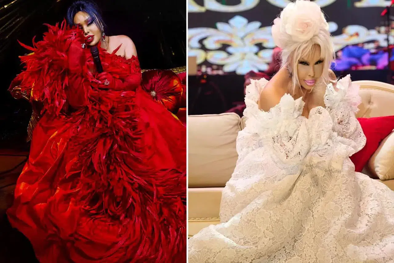 Diva tabularını yıktı: Bülent Ersoy yıllar sonra estetik operasyon geçirdi