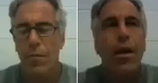 Yüzündeki yarayı gösterip o anları anlattı: Siyah bir adam beni öperken...