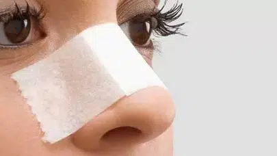 Burun estetiği talebi 15 yaşına kadar indi, ancak…!