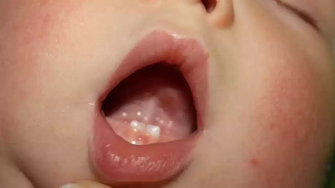 Dişli doğan bebeklerde erken diş çıkması sağlık riski oluşturabilir. Çocuk Diş Hekimi Dt. Nurgül Demir, ailelere dikkat edilmesi gereken önemli bilgiler veriyor.